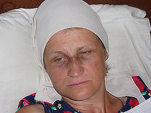 Таксист избил женщину-депутата Одесского горсовета