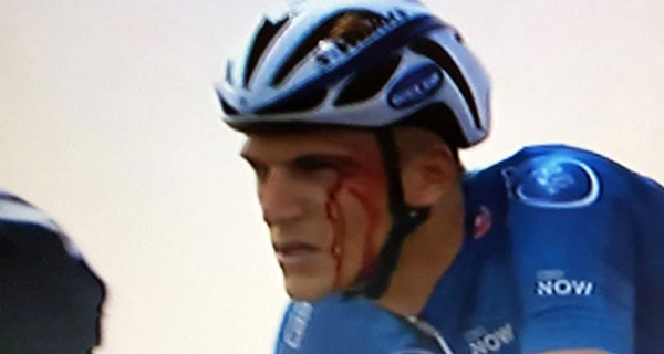 Велогонщик из Украины разбил лицо немцу во время соревнований